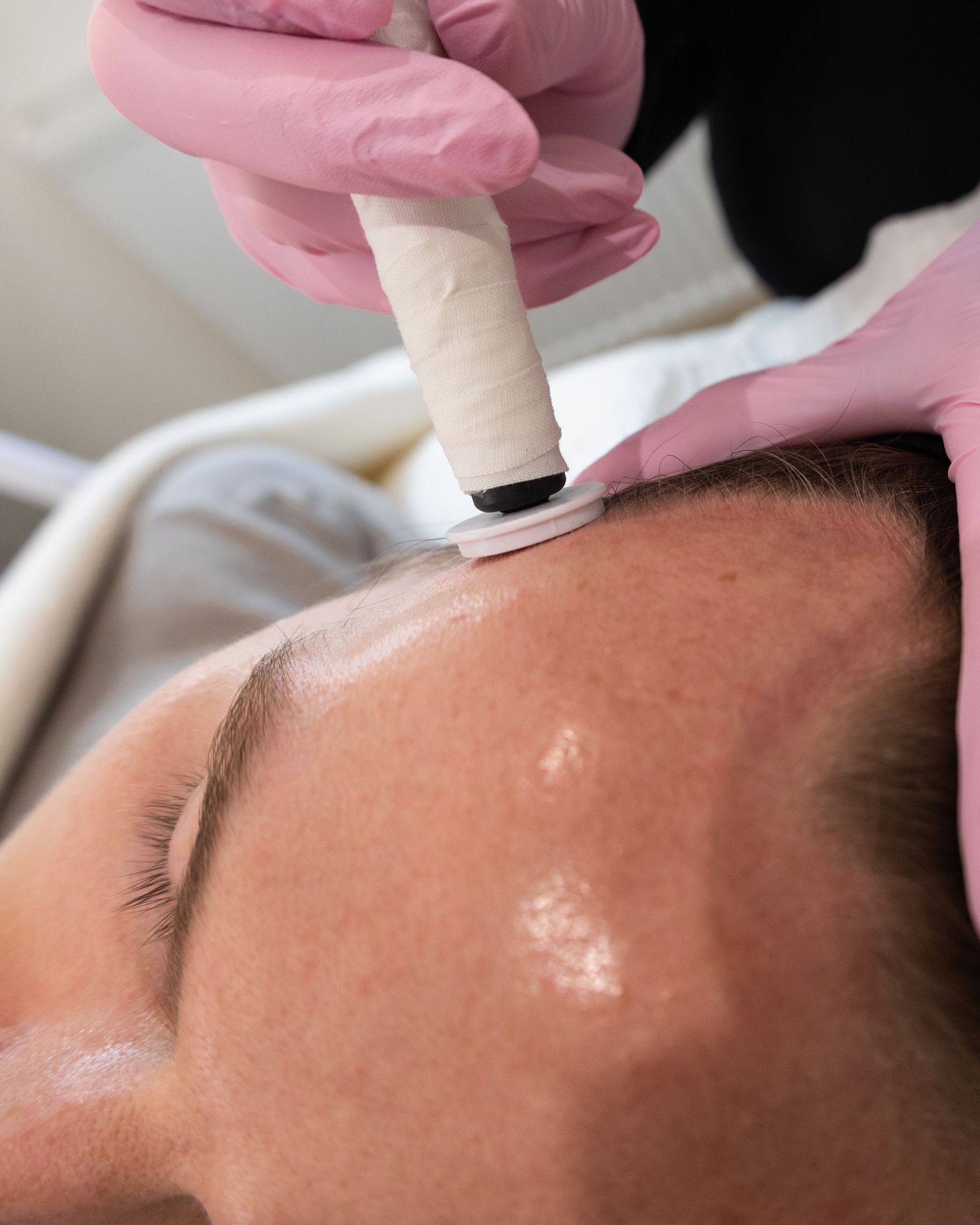 Restorative Hair Follicle Regeneration